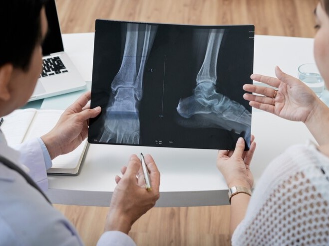 Two doctors looking at an x-ray of the foot.